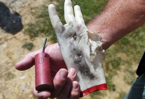 Maryland State Fire Marshal bomb squad member shows the aftermath of a rubber hand that held a quarter stick illegal firework, left, to show the danger of using illegal fireworks.
