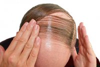 04_05_combover.jpg