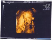 baby girl 5.jpg