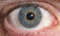 800px-Eye_Central_Heterochromia_crop_and_lighter.jpg
