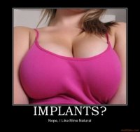 implants-implants-demotivational-poster-1264899192.jpg