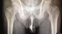 o-MAN-FORK-URETHRA-570.jpg