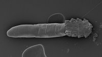 demodex-face-mite.jpg